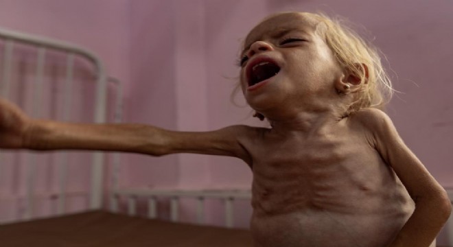 3 Filistinli daha açlık nedeniyle hayatını kaybetti