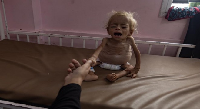 Gazze'de 289 kişi açlık nedeniyle hayatını kaybetti