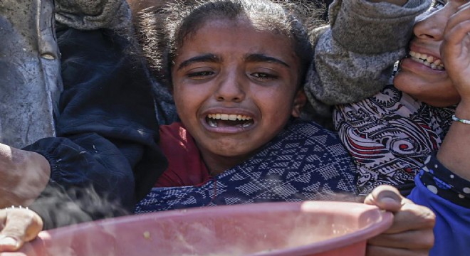 Gazze'de açlık nedeniyle 94 çocuk hayatını kaybetti