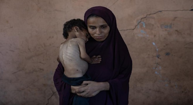Gazze'de açlıktan ölenlerin sayısı 159'a yükseldi